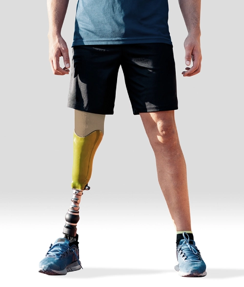 Dynamic Prosthetic Shrinker